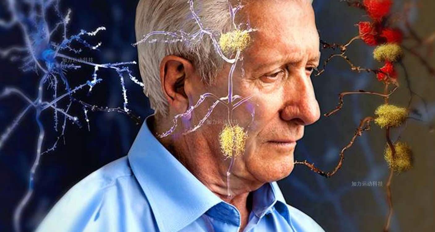 老年痴呆